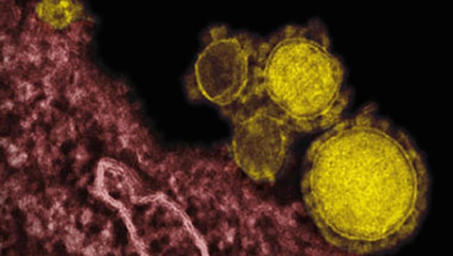 Can Lessons from SARS Cure MERS? Image
