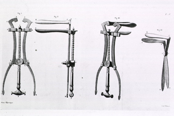 Why No One Can Design A Better Speculum The Atlantic