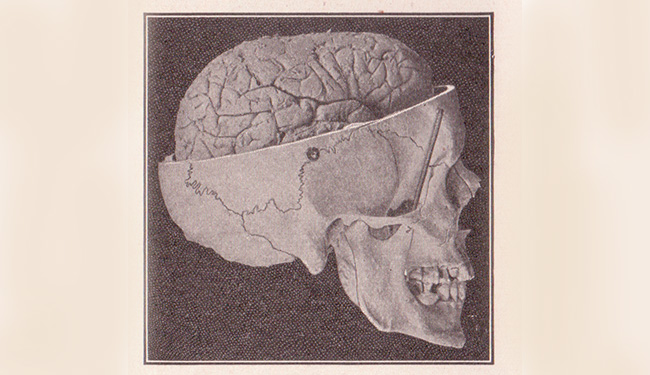 How to Build a Happier Brain - The Atlantic