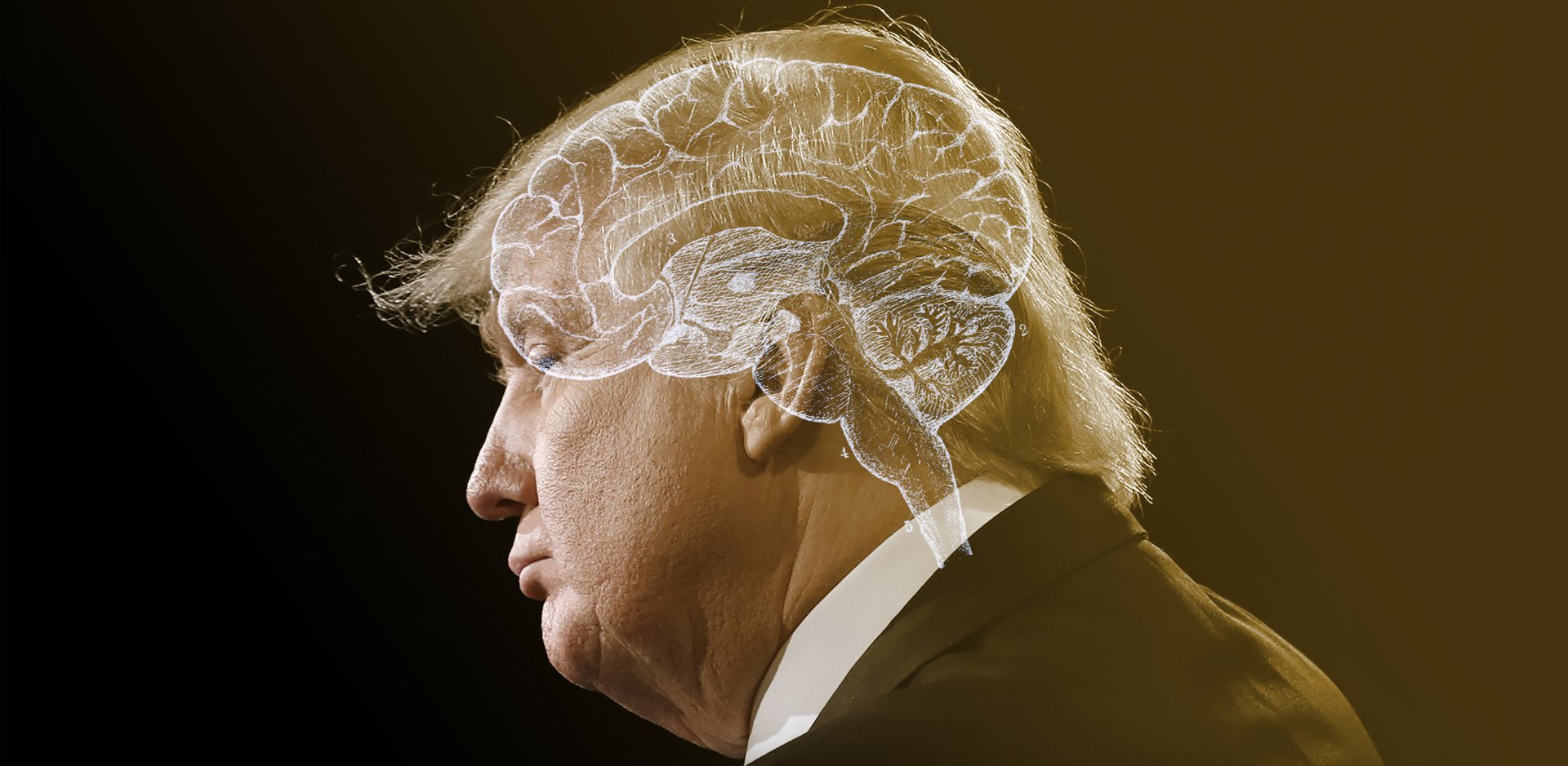 Is There Something Neurologically Wrong With Donald Trump The - a profile of donald trump with the shape of a brain superimpo!   sed