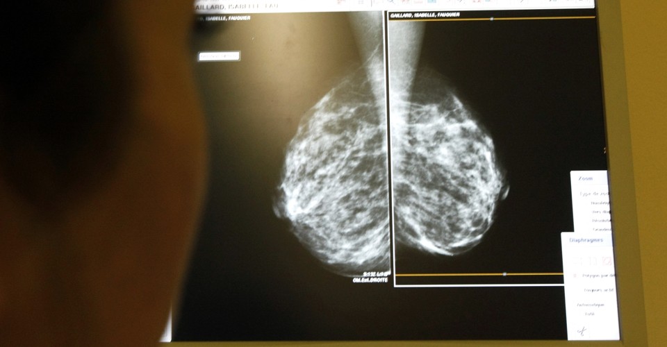 what-dense-breasts-mean-for-cancer-risk-the-atlantic