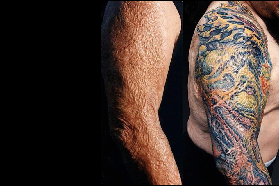 The Firefighter Who Got a Tattoo Over His Skin Graft - The ...