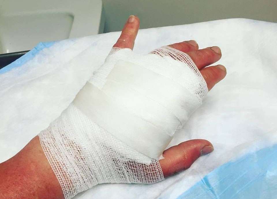 The Science of Margarita Burn - The Atlantic