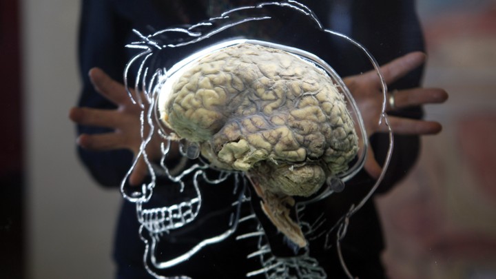 A brain sits inside a glass etching of a human skull.