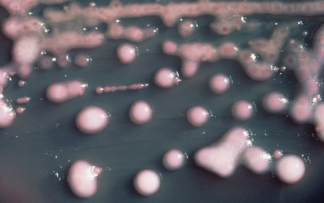 Klebsiella pneumoniae bacteria 