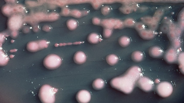 Klebsiella pneumoniae bacteria