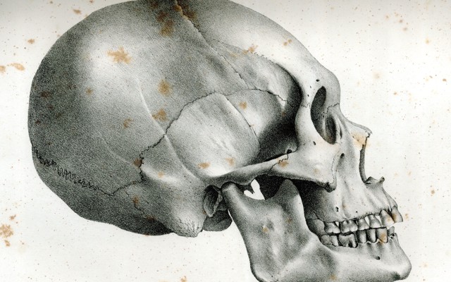A diagram of an "ancient Peruvian skull" from Samuel George Morton's <i>Crania Americana</i>