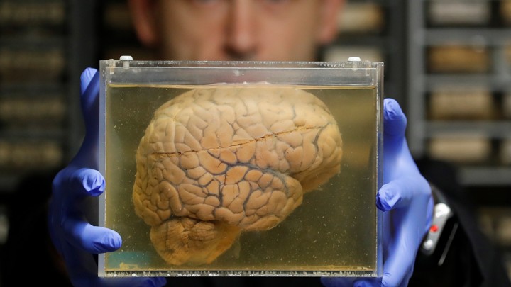 A brain floats in liquid in a container, held by a scientist