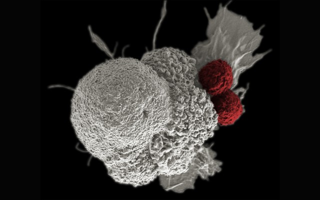 One large white cancer cell being attacked by two smaller red T cells 