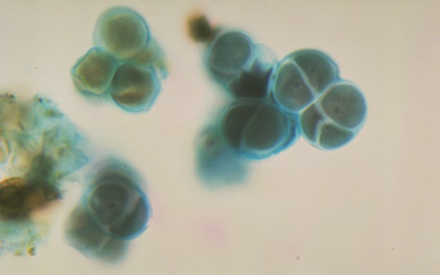 Protococcus blue-green algae, or cyanobacteria
