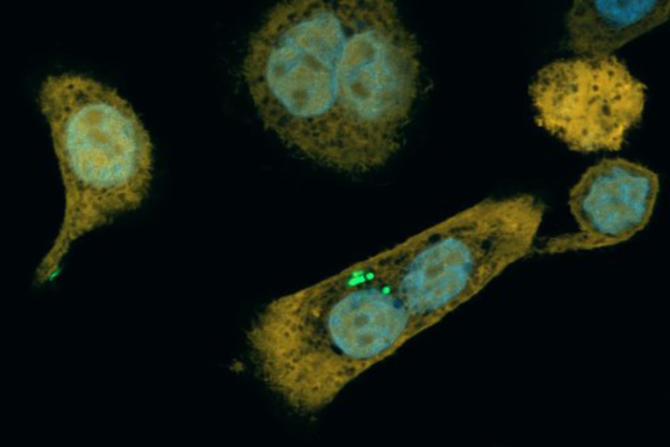 In the picture there are bacteria fluorescing in green inside of a pancreatic cancer cell.