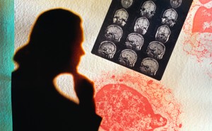 Silhouette of a doctor looking at an MRI scan