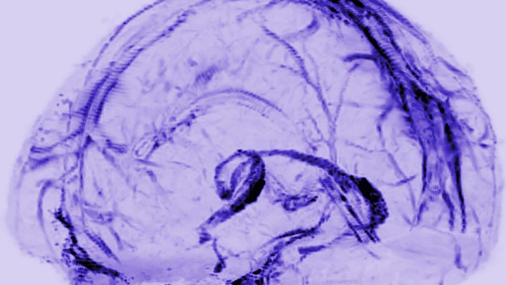 A transparent model of the brain with a network of vessels filled in