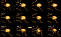 Frames from a video of a large ball-like shape breaking a string-like shape