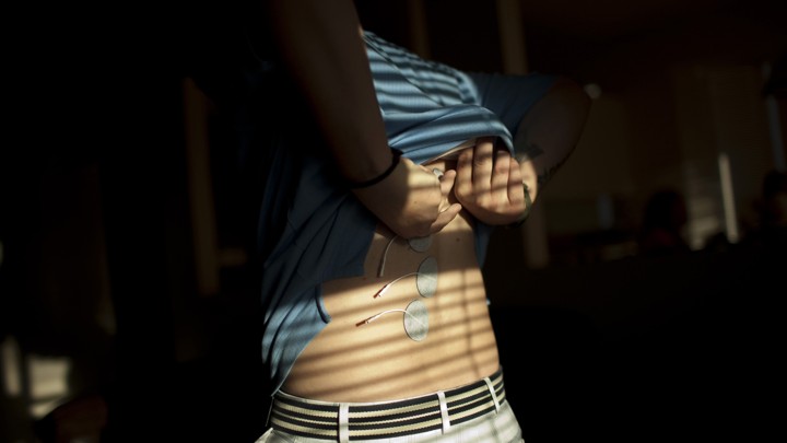 A person applies electrical stimulation pads to their back.