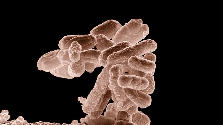 E. coli