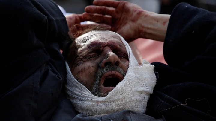 An injured man arrives outside the hospital after a blast in Kabul.