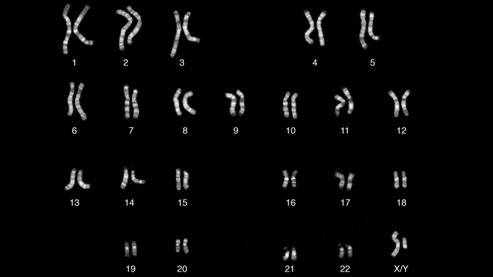 Chromosomes of a male individual, with Y in the lower right corner