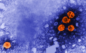 A microscope image of orange hepatitis B particles