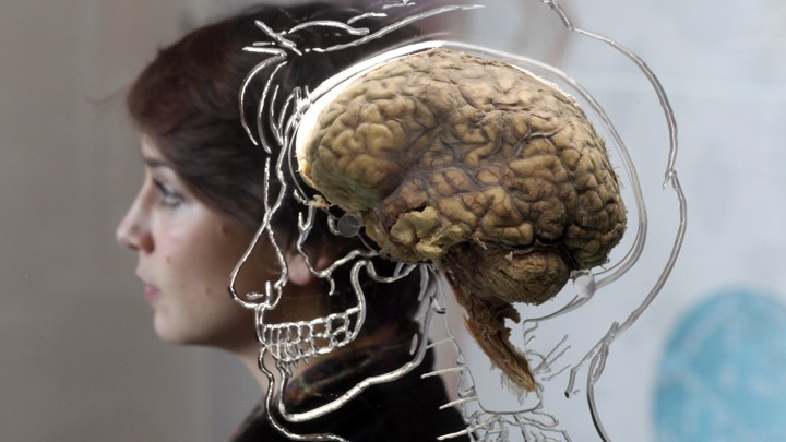 A woman sits besides a real human brain, displayed in Bristol, England.