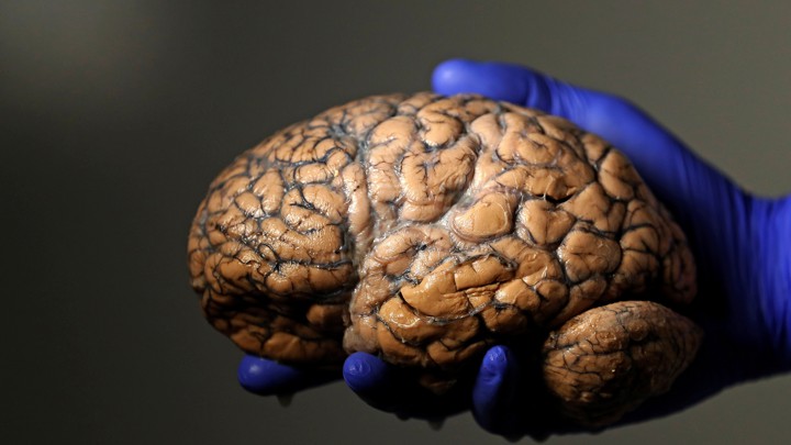 A gloved hand holds a human brain