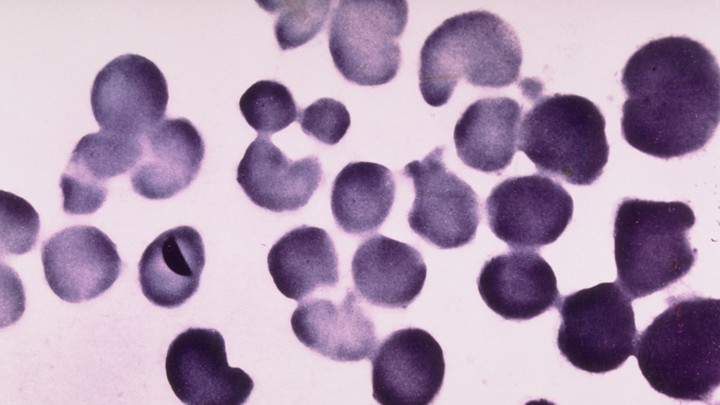 Gonorrhea bacteria