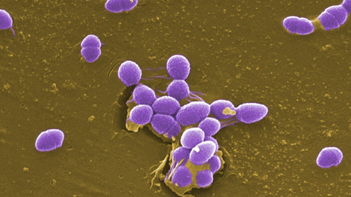 False color micrograph of Enterococcus faecalis