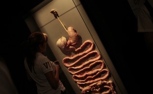 A plastinated human digestive system in a display case