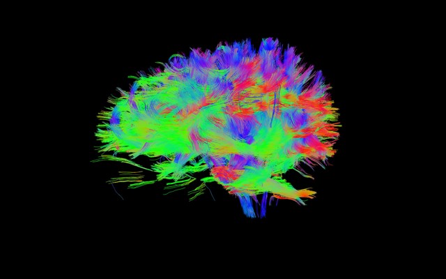 A scan of the author's brain