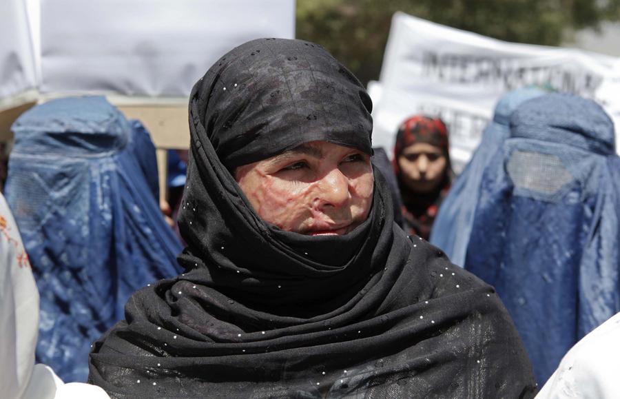 the taliban s war against women women s Although pakistan has in recent years adopted a harder line against taliban militants carrying out attacks 'it's not just women who sometimes regret. the taliban s war against women women s Although pakistan has in recent years adopted a harder line against taliban militants carrying out attacks 'it's not just women who sometimes regret.