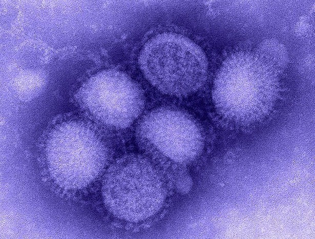 The influenza virus, as viewed through an electron microscope.