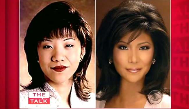 plastic surgery to get asian eyes