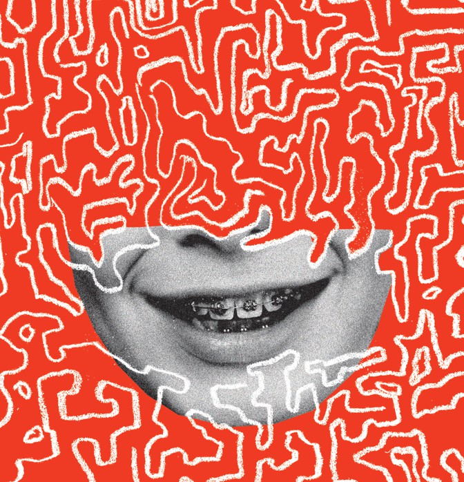 Illustration of smiling mouth with braces on red background surrounded by white squiggles