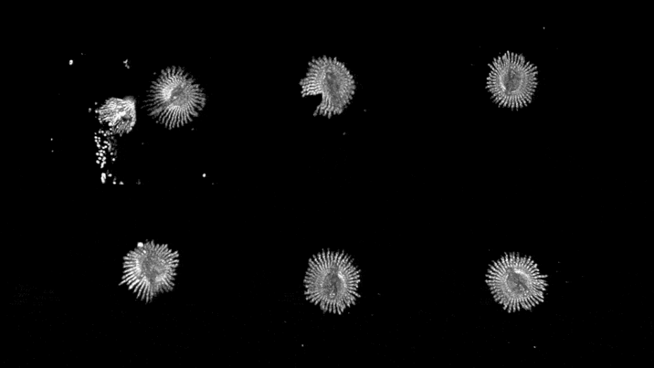 A video of rotating Choanoflagellate collars.