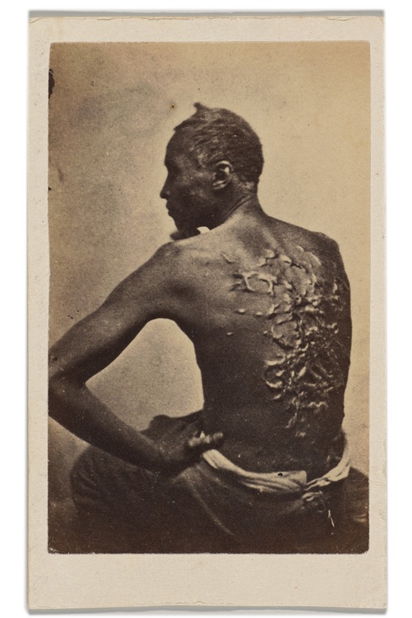 A historical photograph of an enslaved man showing the camera the marks left on his back by his enslavers.