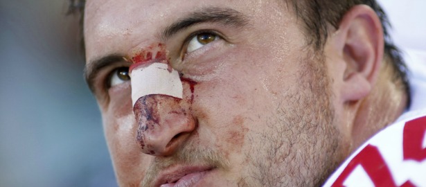 615 football injury bloody face.jpg