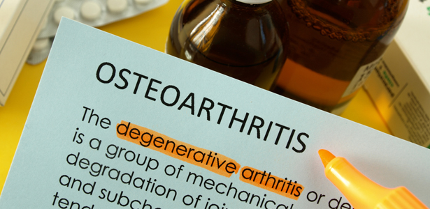 Osteoarthritis-SS-Post.jpg
