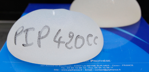 Made of Tissue or Silicon, Breast Implants Require a Lifetime of Care