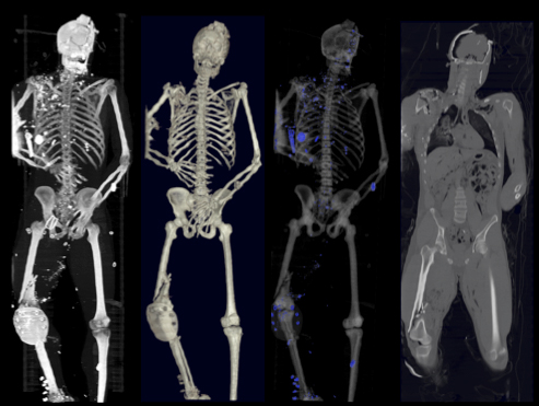 1autopsy-scan.jpg