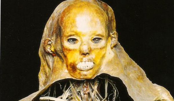 The Mütter Museum's 25 Most Curious And Grotesque Medical Oddities