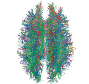 White_Matter_Connections_Obtained_with_MRI_Tractography.jpg