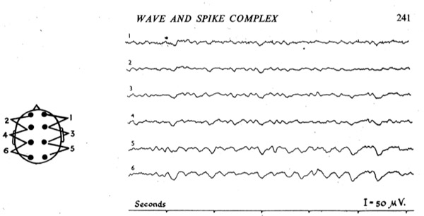 wave and spike.jpg