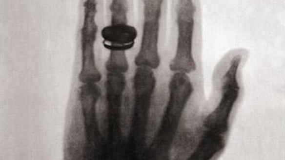 first-x-ray_large.jpg