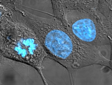 HeLa_cells_stained_with_Hoechst_33258.jpg