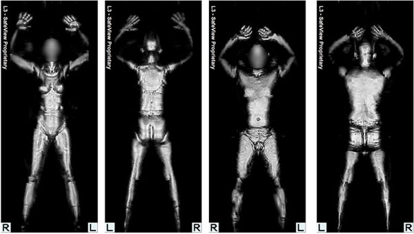 tsa-screening-x-ray-scan-121009-xlg.jpg