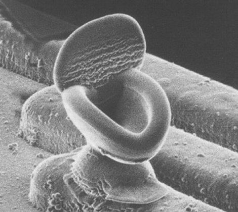 Micrograph