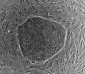 687pxhuman_embryonic_stem_cell_colo