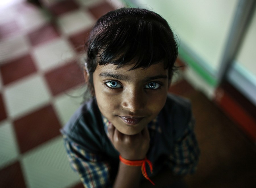 A young girl with very light blue eyes looks up at the camera.