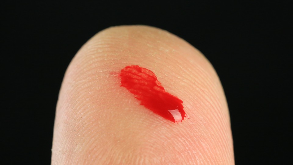 A bright-red drop of blood on a white-skinned fingertip