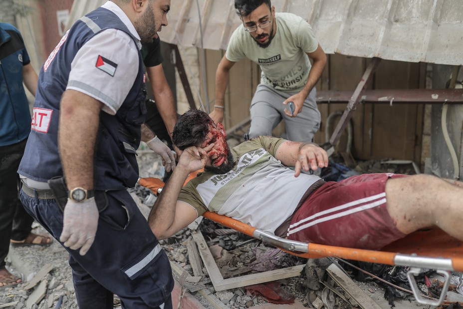 Picture of a Palestinian man injured after Israeli airstrikes destroy buildings in Gaza City, Gaza on October 09, 2023. 